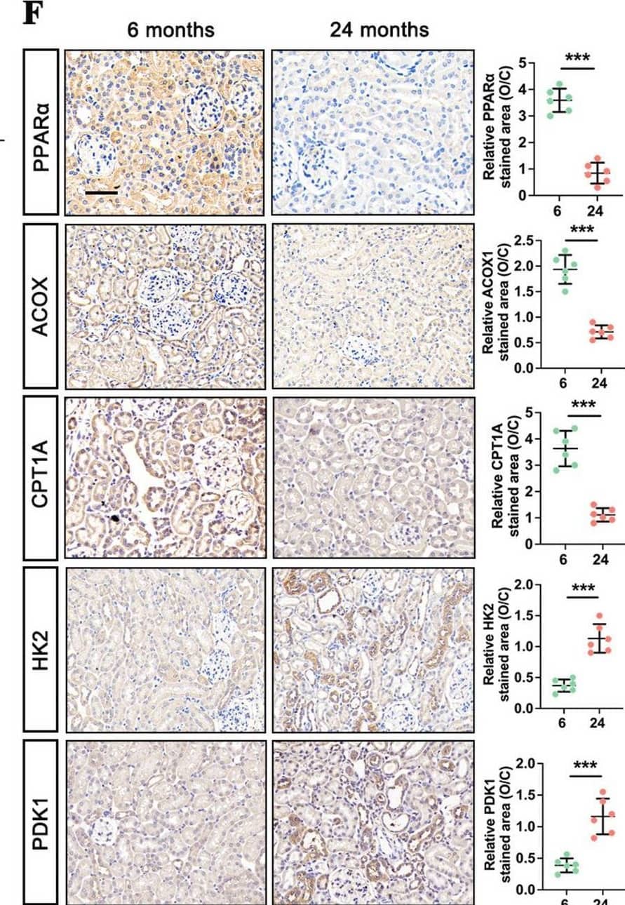The metabolic remodeling process in natural kidney aging. A Representative images of Oil Red O staining in the 24-month-old and 6-month-old group (n = 6), scale bar = 50 μm; B, C the downregulated protein levels of FAO markers (i.e., PPAR alpha , ACOX1, and CPT1A) and upregulated protein levels of glycolysis markers (i.e., HK2 and PDK1) by western blot, and their semi-quantitative analyses (n = 6); D immunostaining for GLIS1 (red) and PPAR alpha  (green), with DAPI (blue) counterstaining by IF staining in the 24-month-old and 6-month-old group (n = 6), scale bar = 50 μm; E lactate levels in the 24-month-old and 6-month-old group (n = 6); F the downregulated protein levels of PPAR alpha , ACOX1, and CPT1A, and up-regulated protein levels of HK2 and PDK1 in the 24-month-old group by IHC assay and their semi-quantitative analyses (n = 6), scale bar = 50 μm. The data are expressed as the mean +/- SD of three independent experiments. **P < .01 or ***P < .001 versus the 6-month-old group by Student’s t-test Image collected and cropped by CiteAb from the following open publication (//pubmed.ncbi.nlm.nih.gov/39736678), licensed under a CC-BY license. Not internally tested by Novus Biologicals.