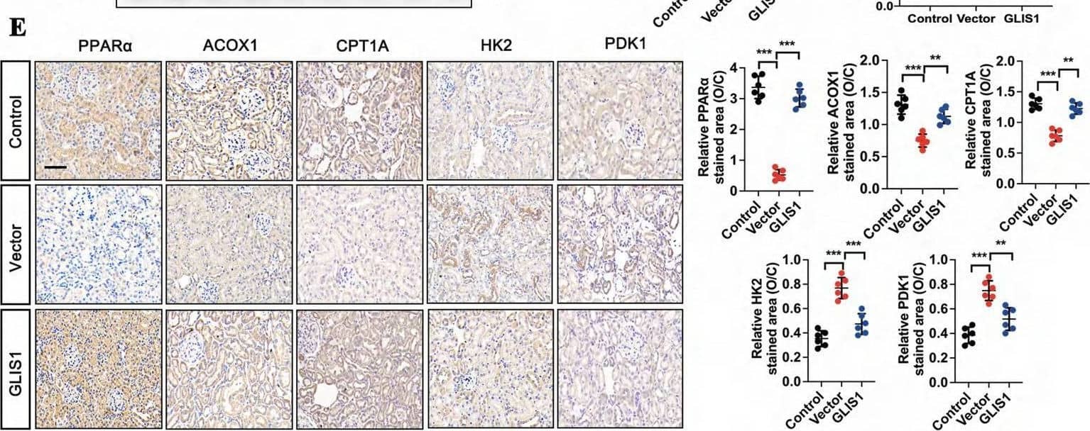 The over-expressed GLIS1 suppressed metabolic remodeling from FAO to glycolysis in the accelerated aging mouse model. A The representative images of mouse kidney tissue in the control, AAV-Vector and AAV-GLIS1 group stained with Oil Red O (n = 6), scale bar = 50 μm; B, C downregulated protein levels of PPAR alpha , ACOX1, and CPT1A in the accelerated aging mouse model were reversed in the presence of AAV-GLIS1, while upregulated protein levels of HK2 and PKD1 in the accelerated aging mouse model were reduced by introducing AAV-GLIS1 (n = 6); D lactate levels in the control, AAV-Vector and AAV-GLIS1 group (n = 6); E the reversed effect of PPAR alpha , ACOX1 and CPT1A levels, as well as HK2 and PDK1 levels in the presence of AAV-GLIS1 by IHC assay, and their semi-quantitative analyses (n = 6), scale bar = 50 μm; F immunostaining for PPAR alpha , ACOX1, CPTA1, HK2, and PDK1 (green), with DAPI (blue) counterstaining by IF staining in accelerated aging mouse model (n = 6), scale bar = 50 μm. The data are expressed as the mean +/- SD of three independent experiments. **P < .01 or ***P < .001 versus the AAV-vector group by one-way ANOVA Image collected and cropped by CiteAb from the following open publication (//pubmed.ncbi.nlm.nih.gov/39736678), licensed under a CC-BY license. Not internally tested by Novus Biologicals.