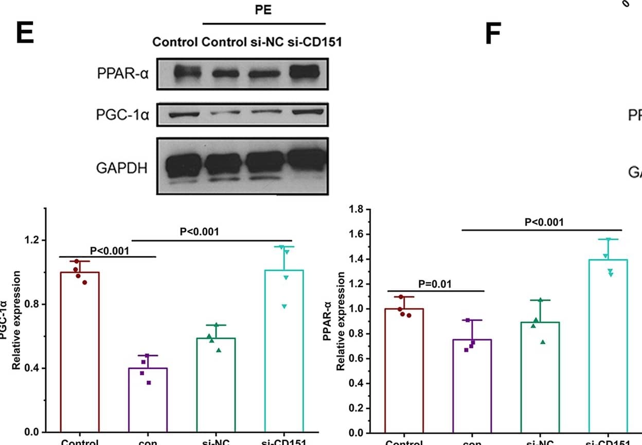 Bioinformatics analysis of proteomic results.(A). Hierarchical clustering analysis of the differentially expressed proteins in the two groups (si-CD151 vs si-NC) (n = 3) (B) The differentially expressed proteins analyzed by volcano plots between every two groups (si-CD151 vs si-NC) (C) Circus plots of GO Classification Annotation of differential protein. (D) KEGG pathways of differentially expressed proteins. OS: Organismal Systems; M: Metabolism; GIP: Genetic Information Processing; CP: Cellular Processes. (E) Western blot analysis of PPAR-alpha , PCG-1 alpha  and GAPDH) in CMs under PE, quantified by Image J (n = 4). (F) Western blot analysis of PPAR-gamma  and GAPDH) in CFs under Ang-II, quantified by Image J (n = 4). Data are expressed as mean +/- SEM. Image collected and cropped by CiteAb from the following open publication (//dx.plos.org/10.1371/journal.pone.0297121), licensed under a CC-BY license. Not internally tested by Novus Biologicals.