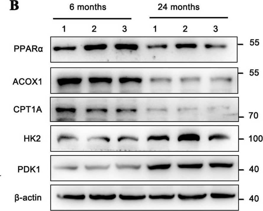 The metabolic remodeling process in natural kidney aging. A Representative images of Oil Red O staining in the 24-month-old and 6-month-old group (n = 6), scale bar = 50 μm; B, C the downregulated protein levels of FAO markers (i.e., PPAR alpha , ACOX1, and CPT1A) and upregulated protein levels of glycolysis markers (i.e., HK2 and PDK1) by western blot, and their semi-quantitative analyses (n = 6); D immunostaining for GLIS1 (red) and PPAR alpha  (green), with DAPI (blue) counterstaining by IF staining in the 24-month-old and 6-month-old group (n = 6), scale bar = 50 μm; E lactate levels in the 24-month-old and 6-month-old group (n = 6); F the downregulated protein levels of PPAR alpha , ACOX1, and CPT1A, and up-regulated protein levels of HK2 and PDK1 in the 24-month-old group by IHC assay and their semi-quantitative analyses (n = 6), scale bar = 50 μm. The data are expressed as the mean +/- SD of three independent experiments. **P < .01 or ***P < .001 versus the 6-month-old group by Student’s t-test Image collected and cropped by CiteAb from the following open publication (//pubmed.ncbi.nlm.nih.gov/39736678), licensed under a CC-BY license. Not internally tested by Novus Biologicals.