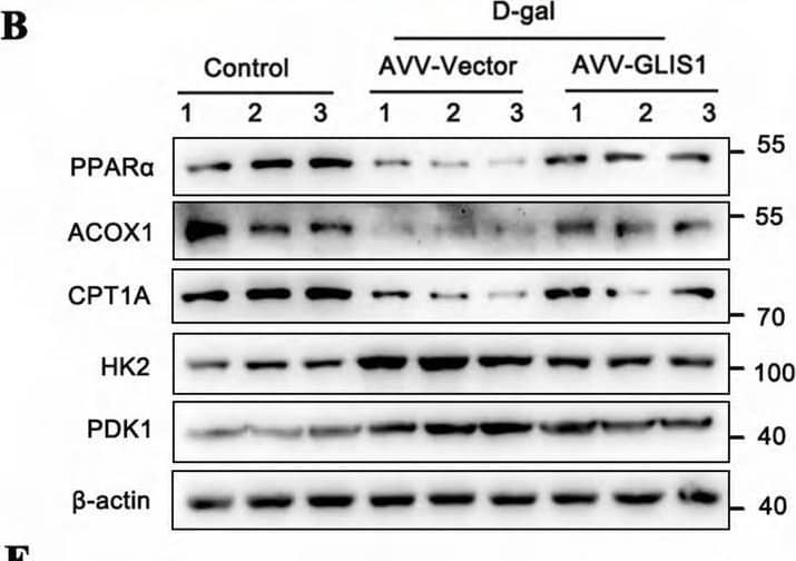 The over-expressed GLIS1 suppressed metabolic remodeling from FAO to glycolysis in the accelerated aging mouse model. A The representative images of mouse kidney tissue in the control, AAV-Vector and AAV-GLIS1 group stained with Oil Red O (n = 6), scale bar = 50 μm; B, C downregulated protein levels of PPAR alpha , ACOX1, and CPT1A in the accelerated aging mouse model were reversed in the presence of AAV-GLIS1, while upregulated protein levels of HK2 and PKD1 in the accelerated aging mouse model were reduced by introducing AAV-GLIS1 (n = 6); D lactate levels in the control, AAV-Vector and AAV-GLIS1 group (n = 6); E the reversed effect of PPAR alpha , ACOX1 and CPT1A levels, as well as HK2 and PDK1 levels in the presence of AAV-GLIS1 by IHC assay, and their semi-quantitative analyses (n = 6), scale bar = 50 μm; F immunostaining for PPAR alpha , ACOX1, CPTA1, HK2, and PDK1 (green), with DAPI (blue) counterstaining by IF staining in accelerated aging mouse model (n = 6), scale bar = 50 μm. The data are expressed as the mean +/- SD of three independent experiments. **P < .01 or ***P < .001 versus the AAV-vector group by one-way ANOVA Image collected and cropped by CiteAb from the following open publication (//pubmed.ncbi.nlm.nih.gov/39736678), licensed under a CC-BY license. Not internally tested by Novus Biologicals.