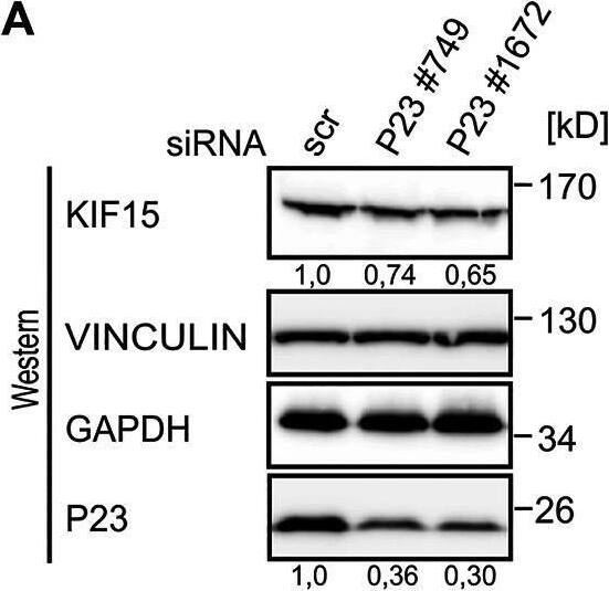 P23 depletion from untreated macrophages results in Kif15 mRNA and protein decline. (A) RAW 264.7 cells were transfected with control (scr) or P23 siRNAs (#749, #1672) (n = 3). Representative Western blot with antibodies as indicated. KIF15 was normalized to VINCULIN and P23 to GAPDH. (B) Analysis of mRNA levels by qPCR, normalized to Ndufv1 mRNA (n = 3). (C) Inhibition of transcription in untreated cells, as indicated (n = 3). Kif15 and Actb mRNAs were monitored by qPCR, normalized to exogenously added Luc mRNA. Statistical analysis was performed with one-way ANOVA, significance levels defined as ** = p < 0.01 and *** = p < 0.001. Image collected and cropped by CiteAb from the following open publication (//pubmed.ncbi.nlm.nih.gov/34179071), licensed under a CC-BY license. Not internally tested by Novus Biologicals.