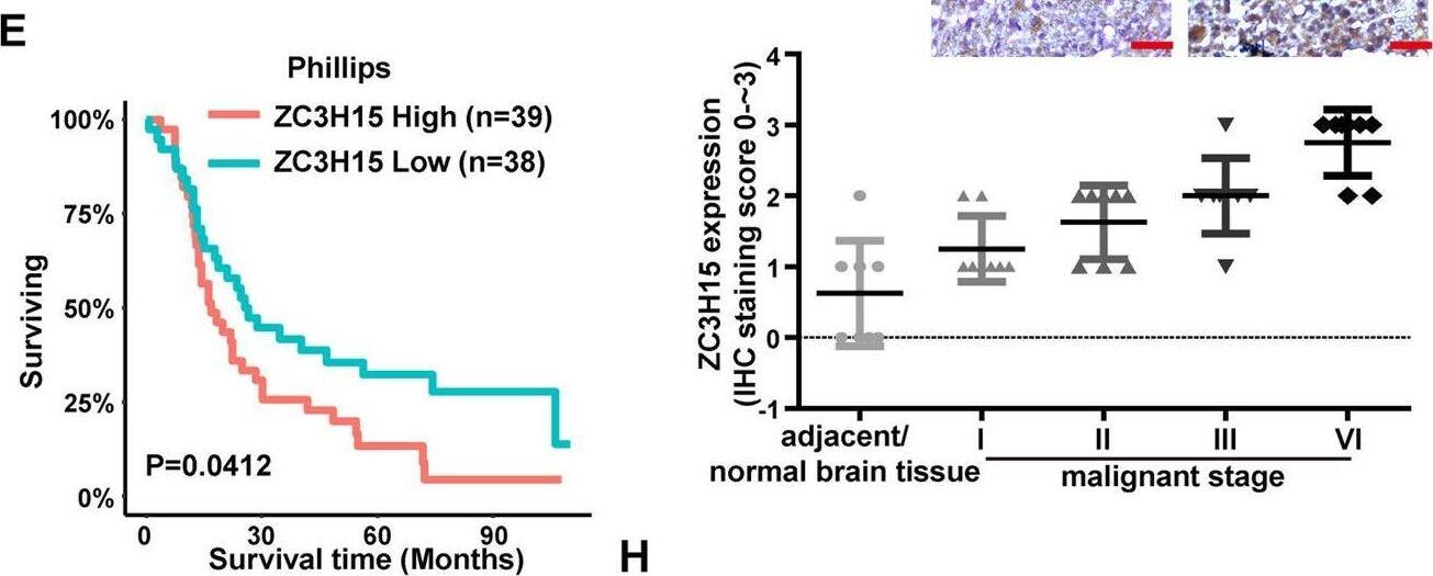 ZC3H15 is commonly upregulated in GBM and correlates with poor prognosis.A, B ZC3H15 gene expression was obtained from TCGA and CGGA database. Box plot of ZC3H15 expression levels in Grade and Histology glioma set with the log-rank test P-values indicated. C Box plot of ZC3H15 expression levels in Copy number glioma set with the log-rank test P-values indicated. D–F The correlation between ZC3H15 expression levels and survival rate were obtained from TCGA, Phillips, and Tumor Glioma-kawaguchi-50 and were performed through Kaplan–Meier (K–M) analysis, the log-rank test P-value was indicated. G Representative immunohistochemistry staining of ZC3H15 expression level in normal tissue and different grades of GBM. And analysis based on the staining of normal tissue (eight samples) and different grades of GBM (eight samples of each group). H The protein and mRNA expression profile of ZC3H15 was examined by qRT-PCR and Western Blot assay. All data were expressed as mean +/- SD. Student’s t test was performed to analyzed significance. *P < 0.05, **P < 0.01, ***P < 0.001. Image collected and cropped by CiteAb from the following open publication (//pubmed.ncbi.nlm.nih.gov/35027542), licensed under a CC-BY license. Not internally tested by Novus Biologicals.