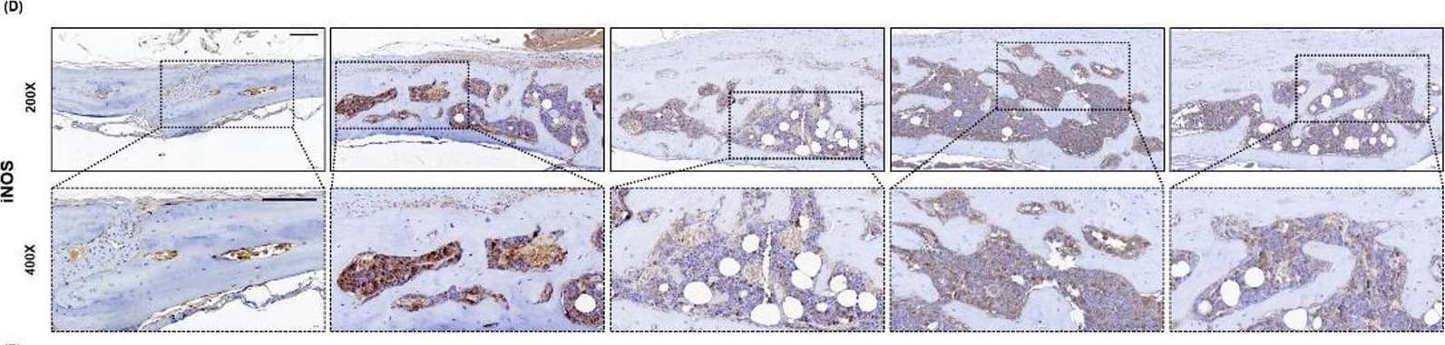 TSA, PXD, or MGCD restore osteoimmune balance and reduce osteolytic activity.  A Histological examination by H&E staining revealed differences in calvarial bone morphology between groups. Immunohistochemical staining demonstrated that treatment with TSA, PXD, or MGCD reduced osteoclast activity, as shown by decreased CTSK expression (B), suppressed M1 macrophage polarization indicated by reduced iNOS expression (D), enhanced M2 macrophage polarization indicated by increased ARG1 expression (F), and promoted osteogenesis as reflected by elevated RUNX2 expression (H). Quantification of CTSK- (C), iNOS- (E), ARG1- (G), and RUNX2- (I) positive cells. Data are presented as mean +/- SD (n = 6 per group). *P < 0.05, **P < 0.01, and ***P < 0.001. Scale bar = 100 μm Image collected and cropped by CiteAb from the following open publication (//pubmed.ncbi.nlm.nih.gov/41174647), licensed under a CC-BY license. Not internally tested by Novus Biologicals.