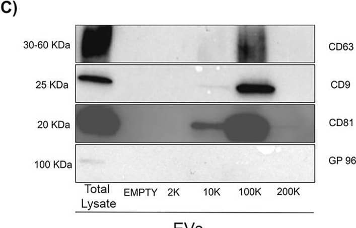 Western Blot gp96/HSP90B1/GRP94 Antibody (9G10)