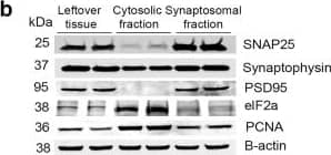Western Blot Synaptophysin Antibody