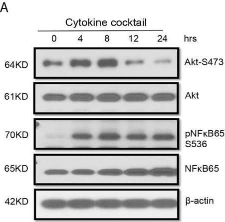 Activation of multiple signaling pathways in TEC challenged by cytokines. Primary human renal TECs were treated with the cytokine cocktail. (A, B) Western blot of PI3K–Akt pathway, NFkb pathway, and Erk signaling pathway in cells treated with cytokine cocktail. (C) Densitometric quantitation of AktS473, pNFkB65, ErkTh202/Ty204, and pTenS380. All Western blots are representative of two independent experiments. Image collected and cropped by CiteAb from the following open publication (//pubmed.ncbi.nlm.nih.gov/34305900), licensed under a CC-BY license. Not internally tested by Novus Biologicals.