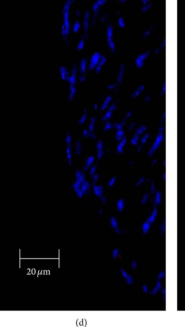 Immunocytochemistry/ Immunofluorescence: SR-BI Antibody - BSA Free [NB400-101] - Immunofluorescent analysis of SR-BI localization in aorta of Tie2-Scarb1 × Scarb1-KO & Scarb1-KO mice. Mouse aorta sections were stained for SR-BI (a & d, red) & CD31 (b & e, green). Colocalization of SR-BI & CD31 was presented on (c) & (f). Blue = DAPI. (a, b, & c) Immunohistological analysis of SR-BI localization in aortic sections of Tie2-Scarb1 × Scarb1-KO mice. Colocalization of SR-BI & CD31 was found in aortic endothelial cells. In several EC stained for SR-B1 red color was present on both apical & basolateral sides (a). (d, e, & f) Immunohistological analysis of SR-BI localization in aortic sections of Scarb1-KO mice. There is no red signal in aorta from Scarb1-KO mice. Image collected & cropped by CiteAb from the following publication (//pubmed.ncbi.nlm.nih.gov/26504816), licensed under a CC-BY license. Not internally tested by Novus Biologicals.