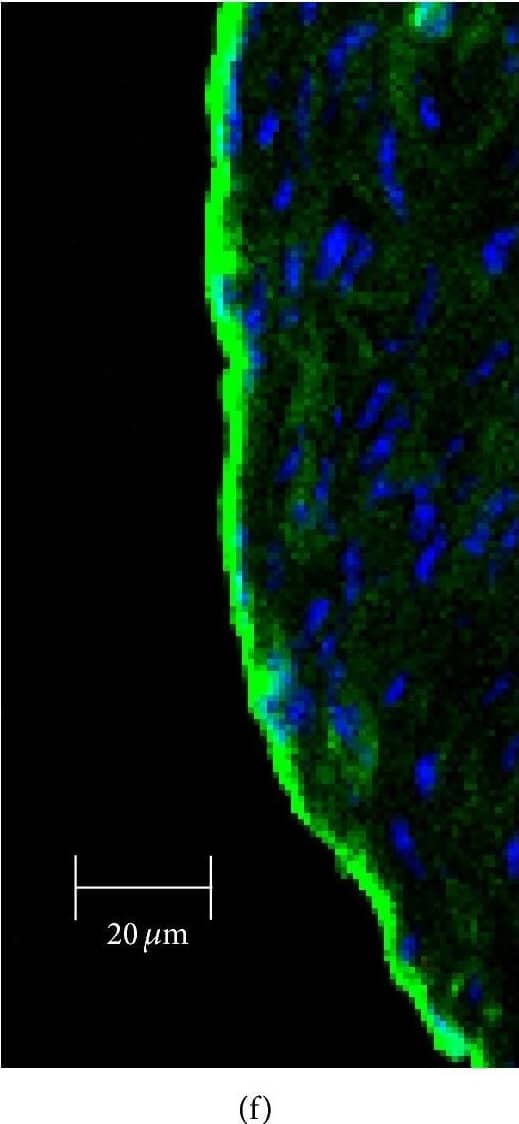 Immunocytochemistry/ Immunofluorescence: SR-BI Antibody - BSA Free [NB400-101] - Immunofluorescent analysis of SR-BI localization in aorta of Tie2-Scarb1 × Scarb1-KO & Scarb1-KO mice. Mouse aorta sections were stained for SR-BI (a & d, red) & CD31 (b & e, green). Colocalization of SR-BI & CD31 was presented on (c) & (f). Blue = DAPI. (a, b, & c) Immunohistological analysis of SR-BI localization in aortic sections of Tie2-Scarb1 × Scarb1-KO mice. Colocalization of SR-BI & CD31 was found in aortic endothelial cells. In several EC stained for SR-B1 red color was present on both apical & basolateral sides (a). (d, e, & f) Immunohistological analysis of SR-BI localization in aortic sections of Scarb1-KO mice. There is no red signal in aorta from Scarb1-KO mice. Image collected & cropped by CiteAb from the following publication (//pubmed.ncbi.nlm.nih.gov/26504816), licensed under a CC-BY license. Not internally tested by Novus Biologicals.