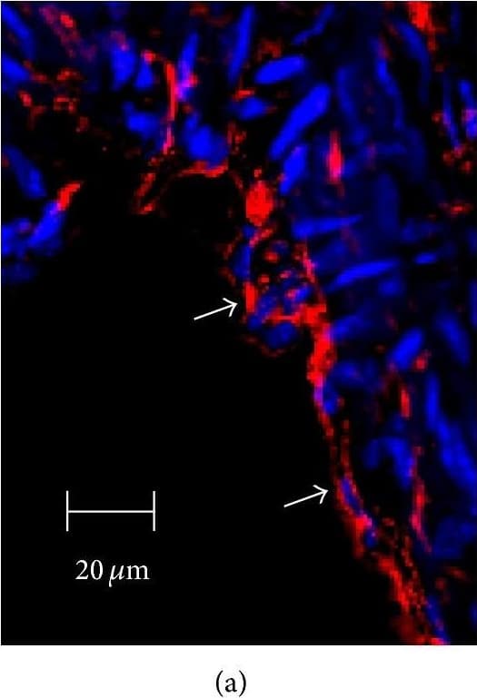 Immunocytochemistry/ Immunofluorescence: SR-BI Antibody - BSA Free [NB400-101] - Immunofluorescent analysis of SR-BI localization in aorta of Tie2-Scarb1 × Scarb1-KO & Scarb1-KO mice. Mouse aorta sections were stained for SR-BI (a & d, red) & CD31 (b & e, green). Colocalization of SR-BI & CD31 was presented on (c) & (f). Blue = DAPI. (a, b, & c) Immunohistological analysis of SR-BI localization in aortic sections of Tie2-Scarb1 × Scarb1-KO mice. Colocalization of SR-BI & CD31 was found in aortic endothelial cells. In several EC stained for SR-B1 red color was present on both apical & basolateral sides (a). (d, e, & f) Immunohistological analysis of SR-BI localization in aortic sections of Scarb1-KO mice. There is no red signal in aorta from Scarb1-KO mice. Image collected & cropped by CiteAb from the following publication (//pubmed.ncbi.nlm.nih.gov/26504816), licensed under a CC-BY license. Not internally tested by Novus Biologicals.