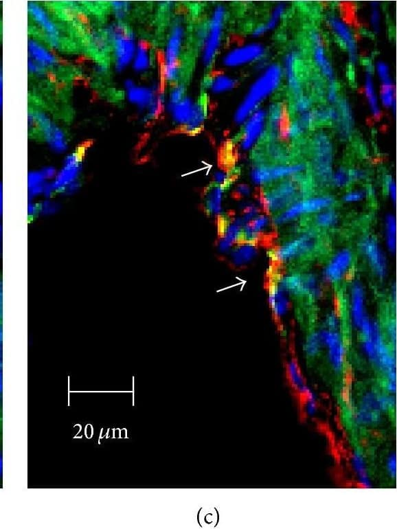 Immunocytochemistry/ Immunofluorescence: SR-BI Antibody - BSA Free [NB400-101] - Immunofluorescent analysis of SR-BI localization in aorta of Tie2-Scarb1 × Scarb1-KO & Scarb1-KO mice. Mouse aorta sections were stained for SR-BI (a & d, red) & CD31 (b & e, green). Colocalization of SR-BI & CD31 was presented on (c) & (f). Blue = DAPI. (a, b, & c) Immunohistological analysis of SR-BI localization in aortic sections of Tie2-Scarb1 × Scarb1-KO mice. Colocalization of SR-BI & CD31 was found in aortic endothelial cells. In several EC stained for SR-B1 red color was present on both apical & basolateral sides (a). (d, e, & f) Immunohistological analysis of SR-BI localization in aortic sections of Scarb1-KO mice. There is no red signal in aorta from Scarb1-KO mice. Image collected & cropped by CiteAb from the following publication (//pubmed.ncbi.nlm.nih.gov/26504816), licensed under a CC-BY license. Not internally tested by Novus Biologicals.