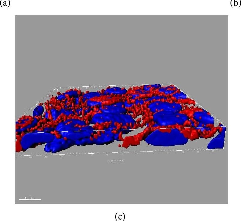 Immunocytochemistry/ Immunofluorescence: SR-BI Antibody - BSA Free [NB400-101] - SR-BI distribution in polarized EC SVEC4-10 cells. SR-BI localization is presented in (a) as x-y image & orthogonal (x-z & y-z) views. (b) & (c) represent rendering of SR-BI staining (red) throughout the cells. Nuclei: blue. In (b) & (c) basolateral surface is on the top & the bottom, respectively. These results demonstrate the presence of SR-BI on both the apical & the basolateral sides of EC. The size of scale bar on (a) is 5 μm & on (b) & (c) 10 μm. Image collected & cropped by CiteAb from the following publication (//pubmed.ncbi.nlm.nih.gov/26504816), licensed under a CC-BY license. Not internally tested by Novus Biologicals.