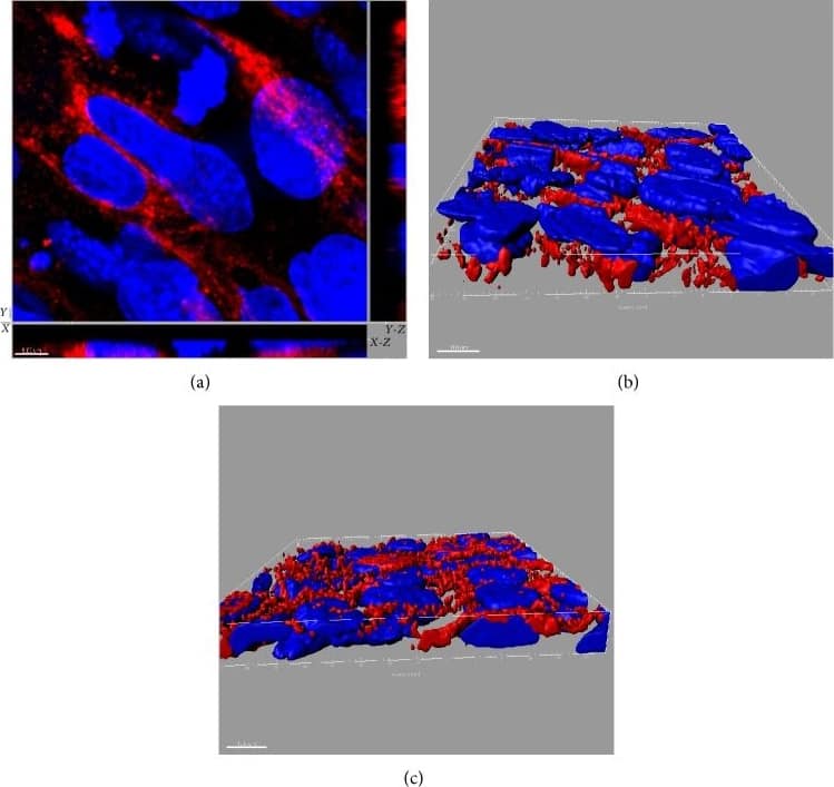 Immunocytochemistry/ Immunofluorescence: SR-BI Antibody - BSA Free [NB400-101] - SR-BI distribution in polarized EC SVEC4-10 cells. SR-BI localization is presented in (a) as x-y image & orthogonal (x-z & y-z) views. (b) & (c) represent rendering of SR-BI staining (red) throughout the cells. Nuclei: blue. In (b) & (c) basolateral surface is on the top & the bottom, respectively. These results demonstrate the presence of SR-BI on both the apical & the basolateral sides of EC. The size of scale bar on (a) is 5 μm & on (b) & (c) 10 μm. Image collected & cropped by CiteAb from the following publication (//pubmed.ncbi.nlm.nih.gov/26504816), licensed under a CC-BY license. Not internally tested by Novus Biologicals.