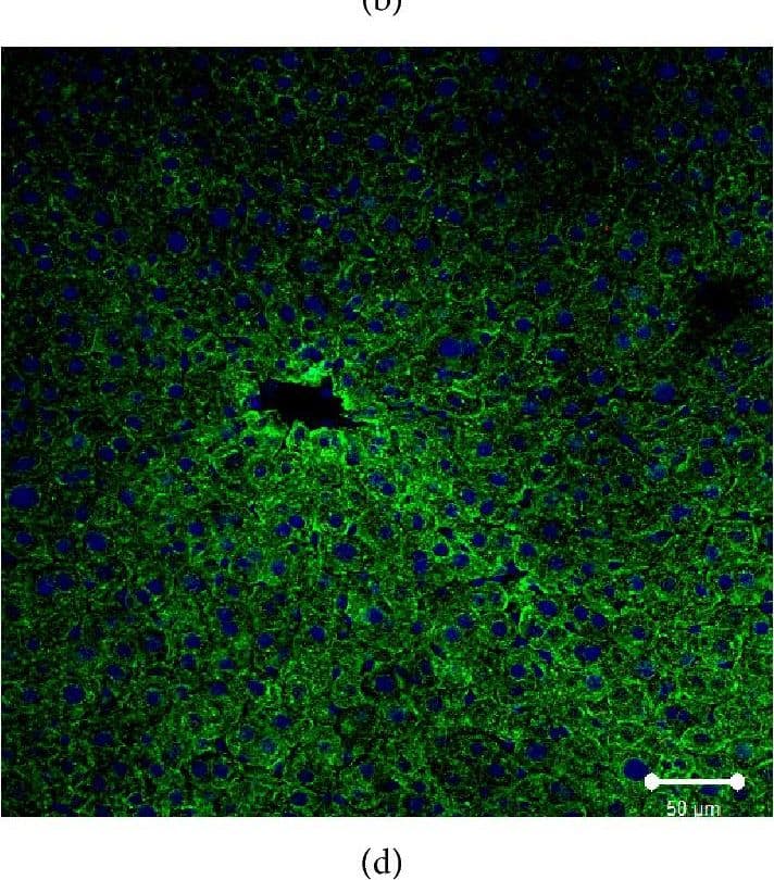 Immunocytochemistry/ Immunofluorescence: SR-BI Antibody - BSA Free [NB400-101] - Immunofluorescent analysis of SR-BI localization in liver of normal, Tie2-Scarb1 × Scarb1-KO, & Scarb1-KO mice. Liver sections from normal (a, b) & Tie2-Scarb1 × Scarb1-KO mice (c) were stained for SR-BI (red) & cytokeratin 8–18 (green). Merge image for normal mouse (b) demonstrates strong presence of SR-BI in hepatocytes (b, yellow signal) & absence of detectable level of SR-BI protein in liver of Tie2-Scarb1 × Scarb1-KO mice (c). In Scarb1-KO mice there was no detectable level of SR-BI protein (d, staining for SR-BI). Blue = DAPI. Image collected & cropped by CiteAb from the following publication (//pubmed.ncbi.nlm.nih.gov/26504816), licensed under a CC-BY license. Not internally tested by Novus Biologicals.