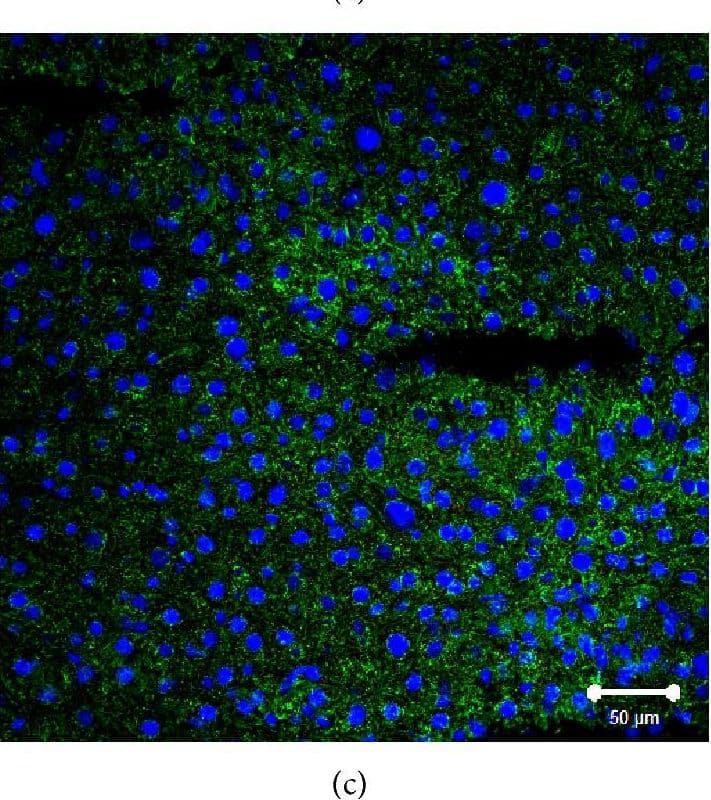 Immunocytochemistry/ Immunofluorescence: SR-BI Antibody - BSA Free [NB400-101] - Immunofluorescent analysis of SR-BI localization in liver of normal, Tie2-Scarb1 × Scarb1-KO, & Scarb1-KO mice. Liver sections from normal (a, b) & Tie2-Scarb1 × Scarb1-KO mice (c) were stained for SR-BI (red) & cytokeratin 8–18 (green). Merge image for normal mouse (b) demonstrates strong presence of SR-BI in hepatocytes (b, yellow signal) & absence of detectable level of SR-BI protein in liver of Tie2-Scarb1 × Scarb1-KO mice (c). In Scarb1-KO mice there was no detectable level of SR-BI protein (d, staining for SR-BI). Blue = DAPI. Image collected & cropped by CiteAb from the following publication (//pubmed.ncbi.nlm.nih.gov/26504816), licensed under a CC-BY license. Not internally tested by Novus Biologicals.