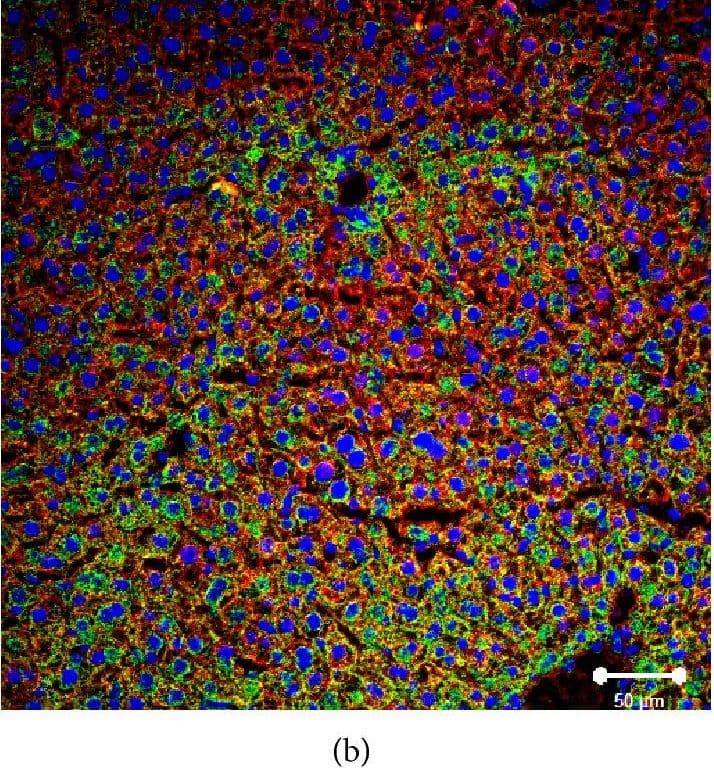 Immunocytochemistry/ Immunofluorescence: SR-BI Antibody - BSA Free [NB400-101] - Immunofluorescent analysis of SR-BI localization in liver of normal, Tie2-Scarb1 × Scarb1-KO, & Scarb1-KO mice. Liver sections from normal (a, b) & Tie2-Scarb1 × Scarb1-KO mice (c) were stained for SR-BI (red) & cytokeratin 8–18 (green). Merge image for normal mouse (b) demonstrates strong presence of SR-BI in hepatocytes (b, yellow signal) & absence of detectable level of SR-BI protein in liver of Tie2-Scarb1 × Scarb1-KO mice (c). In Scarb1-KO mice there was no detectable level of SR-BI protein (d, staining for SR-BI). Blue = DAPI. Image collected & cropped by CiteAb from the following publication (//pubmed.ncbi.nlm.nih.gov/26504816), licensed under a CC-BY license. Not internally tested by Novus Biologicals.