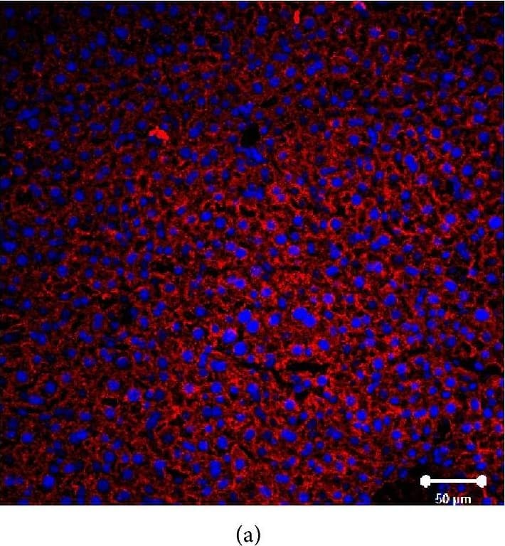 Immunocytochemistry/ Immunofluorescence: SR-BI Antibody - BSA Free [NB400-101] - Immunofluorescent analysis of SR-BI localization in liver of normal, Tie2-Scarb1 × Scarb1-KO, & Scarb1-KO mice. Liver sections from normal (a, b) & Tie2-Scarb1 × Scarb1-KO mice (c) were stained for SR-BI (red) & cytokeratin 8–18 (green). Merge image for normal mouse (b) demonstrates strong presence of SR-BI in hepatocytes (b, yellow signal) & absence of detectable level of SR-BI protein in liver of Tie2-Scarb1 × Scarb1-KO mice (c). In Scarb1-KO mice there was no detectable level of SR-BI protein (d, staining for SR-BI). Blue = DAPI. Image collected & cropped by CiteAb from the following publication (//pubmed.ncbi.nlm.nih.gov/26504816), licensed under a CC-BY license. Not internally tested by Novus Biologicals.