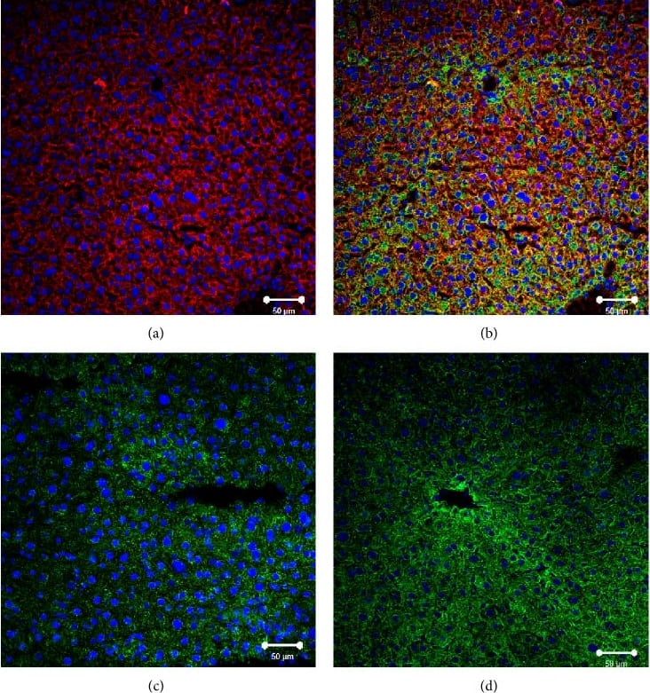 Immunocytochemistry/ Immunofluorescence: SR-BI Antibody - BSA Free [NB400-101] - Immunofluorescent analysis of SR-BI localization in liver of normal, Tie2-Scarb1 × Scarb1-KO, & Scarb1-KO mice. Liver sections from normal (a, b) & Tie2-Scarb1 × Scarb1-KO mice (c) were stained for SR-BI (red) & cytokeratin 8–18 (green). Merge image for normal mouse (b) demonstrates strong presence of SR-BI in hepatocytes (b, yellow signal) & absence of detectable level of SR-BI protein in liver of Tie2-Scarb1 × Scarb1-KO mice (c). In Scarb1-KO mice there was no detectable level of SR-BI protein (d, staining for SR-BI). Blue = DAPI. Image collected & cropped by CiteAb from the following publication (//pubmed.ncbi.nlm.nih.gov/26504816), licensed under a CC-BY license. Not internally tested by Novus Biologicals.