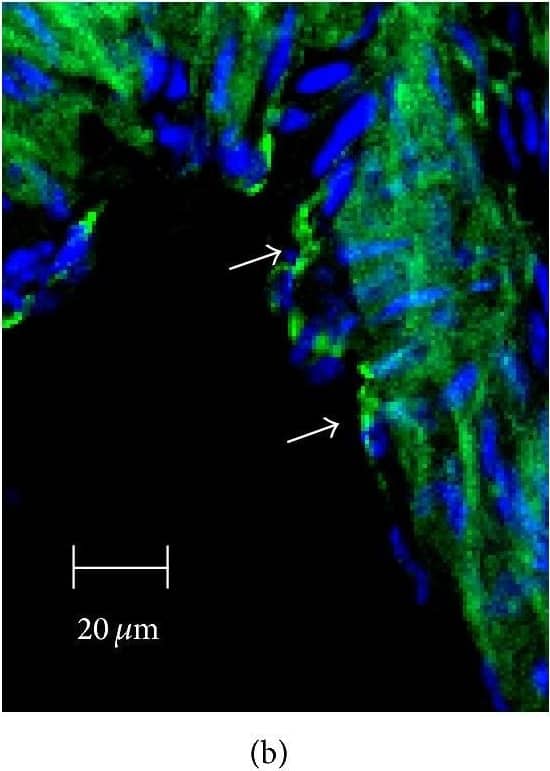 Immunocytochemistry/ Immunofluorescence: SR-BI Antibody - BSA Free [NB400-101] - Immunofluorescent analysis of SR-BI localization in aorta of Tie2-Scarb1 × Scarb1-KO & Scarb1-KO mice. Mouse aorta sections were stained for SR-BI (a & d, red) & CD31 (b & e, green). Colocalization of SR-BI & CD31 was presented on (c) & (f). Blue = DAPI. (a, b, & c) Immunohistological analysis of SR-BI localization in aortic sections of Tie2-Scarb1 × Scarb1-KO mice. Colocalization of SR-BI & CD31 was found in aortic endothelial cells. In several EC stained for SR-B1 red color was present on both apical & basolateral sides (a). (d, e, & f) Immunohistological analysis of SR-BI localization in aortic sections of Scarb1-KO mice. There is no red signal in aorta from Scarb1-KO mice. Image collected & cropped by CiteAb from the following publication (//pubmed.ncbi.nlm.nih.gov/26504816), licensed under a CC-BY license. Not internally tested by Novus Biologicals.