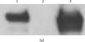 Western Blot: SR-BI Antibody - BSA Free [NB400-101] - Western blot & Coomassie stain of membrane fractions isolated from livers of normal C57Bl/6N (lane 1), Scarb1-KO (lane 2), & LIV11-SCARB1 × Scarb1-KO (lane 3) mice. 20 μg of membrane protein was loaded into each lane. (a) Western blot (anti-SR-BI antibody). (b) Coomassie stain (loading control for Western blot) encompassing the same MW region as SR-BI. Aliquots from the same tube were loaded for the Western blot & for the Coomassie-stained gel, which shows comparable loading between the three samples. Image collected & cropped by CiteAb from the following publication (//pubmed.ncbi.nlm.nih.gov/26504816), licensed under a CC-BY license. Not internally tested by Novus Biologicals.