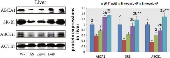Western Blot: SR-BI Antibody - BSA Free [NB400-104] - Protein expressions of ABCA1, SR-BI & ABCG1 in liver & macrophage by Western blot. Simvastatin increased the expressions of ABCA1 & ABCG1 in liver & ABCA1 in macrophage, Both L-4F & the combination group improved the expressions of ABCA1, SR-BI & ABCG1 in liver & ABCA1 & ABCG1 in macrophage. 1P < 0.05, 2P < 0.001, vs. AS group; aP < 0.05, bP < 0.001, vs. Simva group;*P < 0.05, **P < 0.001, vs. L-4F group. Image collected & cropped by CiteAb from the following publication (//lipidworld.biomedcentral.com/articles/10.1186/1476-511X-12-180), licensed under a CC-BY license. Not internally tested by Novus Biologicals.