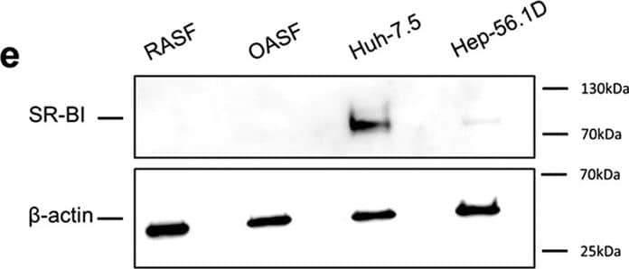 Western Blot: SR-BI Antibody - BSA Free [NB400-104] - Expression of cellular HCV receptors at the mRNA & protein levels.(a) mRNA copy numbers of CD81, occluding (OCLN), claudin-1 (CLDN1) & SR-BI were quantified in OASF, RASF & Huh-7.5 cells, normalized to the reference gene GAPDH. (b) Detection of CD81 on Huh-7.5 cells, OASF, & RASF by FACS analysis. (c–d) Detection of OCLN, CLDN1 & SR-BI in OASF & RASF by immunoblot analysis. Huh-7.5 cells were used as positive control & Hep-56.1D as negative control. In both the real-time PCR & the FACS analysis experiments the number of biological replicates was 3 & the number of experimental replicates was 2 (total n = 6). In immunoblotting detection, the number of biological replicates was 2 & the number of experimental replicates was 2 (n = 4). Image collected & cropped by CiteAb from the following publication (//pubmed.ncbi.nlm.nih.gov/26643193), licensed under a CC-BY license. Not internally tested by Novus Biologicals.