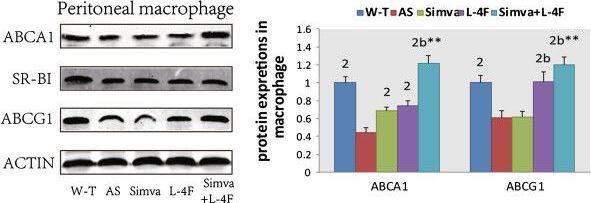 Western Blot: SR-BI Antibody - BSA Free [NB400-104] - Protein expressions of ABCA1, SR-BI & ABCG1 in liver & macrophage by Western blot. Simvastatin increased the expressions of ABCA1 & ABCG1 in liver & ABCA1 in macrophage, Both L-4F & the combination group improved the expressions of ABCA1, SR-BI & ABCG1 in liver & ABCA1 & ABCG1 in macrophage. 1P < 0.05, 2P < 0.001, vs. AS group; aP < 0.05, bP < 0.001, vs. Simva group;*P < 0.05, **P < 0.001, vs. L-4F group. Image collected & cropped by CiteAb from the following publication (//lipidworld.biomedcentral.com/articles/10.1186/1476-511X-12-180), licensed under a CC-BY license. Not internally tested by Novus Biologicals.