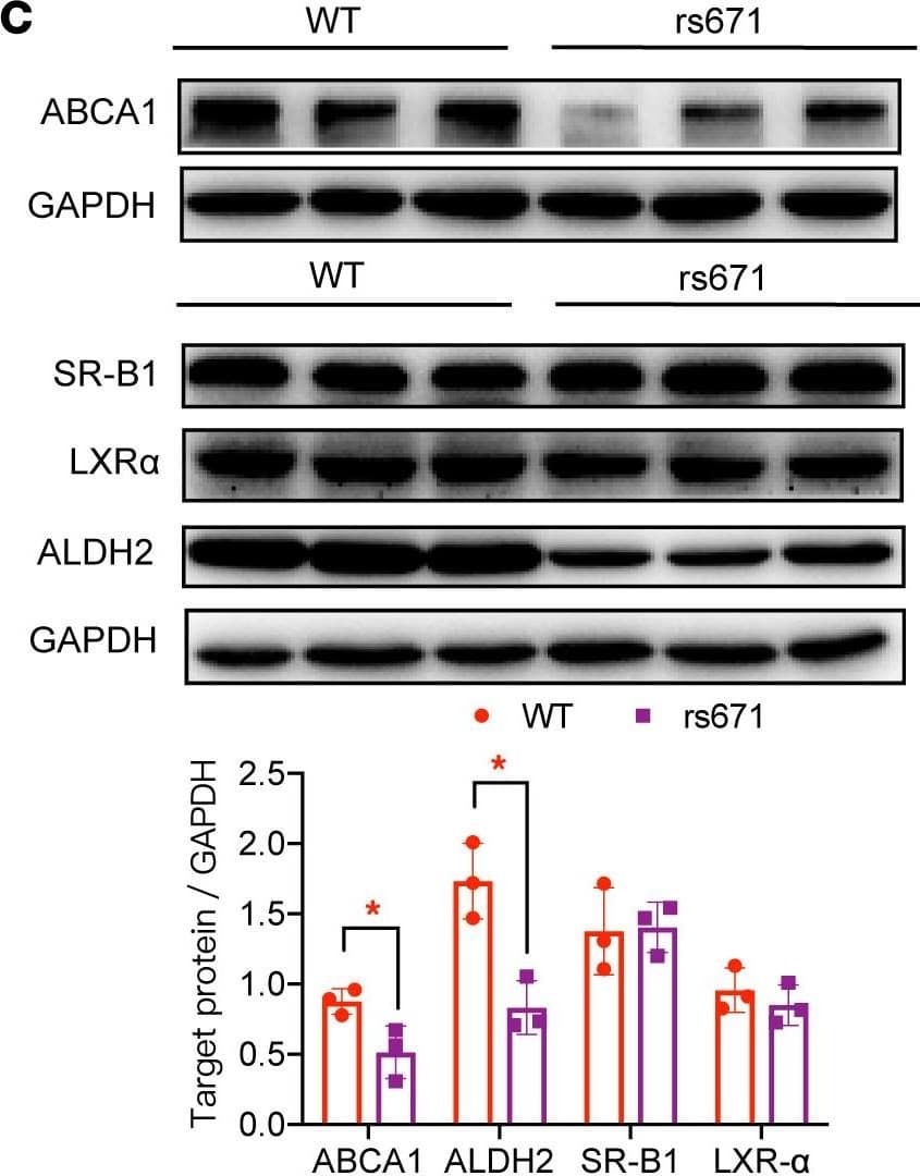 Immunocytochemistry/ Immunofluorescence: SR-BI Antibody - BSA Free [NB400-104] - ALDH2 rs671 modulates HDL-C levels in mice & human liver through increasing poly(ADP-ribosyl)ation of LXR alpha  due to attenuated ALDH2/PARP1 interaction.(A) Representative H&E & Oil Red O staining for mouse liver fed with a Western diet (WD) for 8 weeks (WT & ALDH2 rs671-KI mice, referred to as rs671). Scale bar: 100 μm. (B) HDL-C in plasma at 16th week (WD for 8 weeks). WT, n = 9; rs671, n = 10. (C) Western blotting analysis of ABCA1, ALDH2, LXR alpha , & SR-B1 expression in mouse liver tissue. WT, n = 3; rs671, n = 3. (D) IP results of WT ALDH2 or ALDH2 rs671, PARP1. (E) IP results of ALDH2 & PARP1 in human liver tissues. WT, n = 3; rs671, n = 3. Experiments were repeated 3 times. (F) ALDH2 rs671 significantly increased nuclear translocation of PARP1 in human liver tissue. WT, n = 3; rs671, n = 3. Statistical comparisons were made using a 2-tailed Student’s t test. All data are mean ± SD. *P < 0.05, **P < 0.01, ***P < 0.001. Image collected & cropped by CiteAb from the following publication (//pubmed.ncbi.nlm.nih.gov/35393951), licensed under a CC-BY license. Not internally tested by Novus Biologicals.