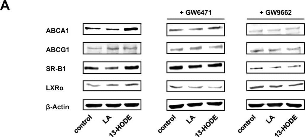 Western Blot: SR-BI Antibody - BSA Free [NB400-104] - Effects of 13-HODE & LA in the presence & absence of PPAR alpha  & PPAR gamma  selective antagonists on molecular markers of cholesterol homeostasis in RAW264.7 macrophages. RAW264.7 cells were pre-treated without or with the PPAR alpha  selective antagonist GW6471 or the PPAR gamma  selective antagonist GW9662 & subsequently treated without (vehicle control) or with 2.5 μmol/L 13-HODE or 100 μmol/L LA for 24 h. Afterwards, cells were lysed & subsequently processed for western blotting as described in the materials & methods section. A, Representative immunoblots specific for ABCA1, ABCG1, SR-BI, LXR alpha , &  beta -actin which was used for normalization are shown. B, Bars represent data from densitometric analysis & are means ± SD from three independent experiments (n = 3). Data are expressed as percentage of protein concentration of vehicle control cells. Results from statistical analysis are indicated: Significant effects are denoted with superscript letters. Bars marked without a common superscript letter significantly differ (P < 0.05). Image collected & cropped by CiteAb from the following publication (//lipidworld.biomedcentral.com/articles/10.1186/1476-511X-10-222), licensed under a CC-BY license. Not internally tested by Novus Biologicals.