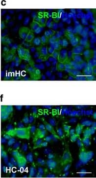 Immunocytochemistry/ Immunofluorescence: SR-BI Antibody - BSA Free [NB400-104] - Identification of Plasmodium sporozoite-associated receptors on immortalized hepatocyte-like cells (imHCs). The expression of Plasmodium sporozoite-associated receptors (CD81, EphA2 & SR-BI) on imHCs & HC-04 cells was determined using immunofluorescent staining. Prior to analysis, the hepatocytes were grown in MEM/F12 medium containing 10% fetal bovine serum until confluence was reached. The expression of CD81 (a), EphA2 (b) & SR-BI (c) on imHCs & HC-04 cells was compared (d, e, f, respectively). Hepatocyte nuclei were stained with Hoechst 33342 dye. Fluorescence images were captured & analysed using an Operetta High-Content Imaging System (PerkinElmer) with a ×40 objective lens. Scale bar = 50 μm. Cells expressing CD81, EphA2 or SR-BI were quantified from 15 randomly selected image fields (total number of analysed cells > 2000) (g, h, i, respectively). Bar graph shows the mean percentage of positively stained cells. Error bars depict standard deviations. ****p < 0.0001, Student’s t test Image collected & cropped by CiteAb from the following publication (//pubmed.ncbi.nlm.nih.gov/29370800), licensed under a CC-BY license. Not internally tested by Novus Biologicals.