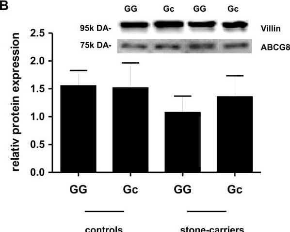 <b>Genetic Strategies Validation. </b>Correlation of ABCG8 expression to the frequency of the polymorphism D19H in the Stuttgart cohort. The expression analysis was performed in human ileal mucosal biopsies. Values are given as means +/- SEM. Significance between the subgroups was analysed with Mann–Whitney U-test (nonparametric, two-tailed). P-values <0.05 were considered as statistically significant. (A) Quantitative analysis of mRNA expression is calculated as copy numbers. (GG) = wild type individual; (Gc) = carrier of p.D19H. Controls: (GG) = 80 and (Gc) = 15; gallstone carriers: (GG) = 20 and (Gc) = 9. (B) Representative Western blot images of ABCG8 protein and villin in ileal mucosa of control individuals and gallstone carriers, with and without p.D19H. Protein content was determined by densitometric analysis. The data were normalized to villin, an epithelial marker protein. Controls: (GG) = 59 and (Gc) = 11; gallstone carriers: (GG) = 11 and (Gc) = 9. Image collected and cropped by CiteAb from the following open publication (//pubmed.ncbi.nlm.nih.gov/23406058), licensed under a CC-BY license. Not internally tested by Novus Biologicals.