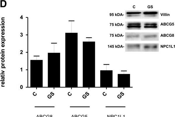 <b>Genetic Strategies Validation. </b>Correlation of ABCG8 expression to the frequency of the polymorphism D19H in the Stuttgart cohort. The expression analysis was performed in human ileal mucosal biopsies. Values are given as means +/- SEM. Significance between the subgroups was analysed with Mann–Whitney U-test (nonparametric, two-tailed). P-values  25.4. P-values <0.05 were considered as statistically significant. (A-C) Quantification of mRNA expression is given as transcript numbers. ABCG5/ABCG8 = ATP-binding cassette transporter, NPC1L1 = Niemann-Pick C1-Like 1 protein *P = 0.0417, C = control subject, GS = gallstone carrier. Total: C = 98, GS = 30; normal weight: C = 57, GS = 10; overweight: C = 41, GS = 20. (D) Representative Western blot images of ABCG8, ABCG5 and NPC1L1 in ileal mucosa of gallstone carriers and controls. Protein content was determined by densitometric analysis. The data were normalized to villin, an epithelial marker protein. ABCG8: C = 70, GS = 20; ABCG5: C = 7, GS = 7; NPC1L1: C = 7, GS = 7. Image collected and cropped by CiteAb from the following open publication (//pubmed.ncbi.nlm.nih.gov/23406058), licensed under a CC-BY license. Not internally tested by Novus Biologicals.