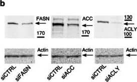 Western Blot: Fatty Acid Synthase/FASN Antibody [NB400-114] - Fatty acid synthesis requirement for CHIKV life cycle.(a) Impact of FASN or ACLY knockdown on CHIKV replication. Closed & open symbols indicate replicates from the primary screen & during validation, respectively. (b) Western blot showing silencing efficiency of siRNAs used in c. (c) Impact of FASN-, ACC- & ACLY-specific siRNAs on CHIKV replication (n=10 for each data set). (d) Confocal section of CHIKV replicon-infected HeLa cells labelled for FASN, dsRNA & 4,6-diamidino-2-phenylindole (DAPI; blue). Scale bar, 10 μm. (e) Co-localization analysis of cells labelled as in d & in Supplementary Fig. 3b, plotted as Pearson's coefficient per cell. Each symbol corresponds to a cell stack from three independent experiments (n=29 cells for FASN, 30 cells for ACC & 31 cells for ACLY); median values shown in red. (f) Effect of FASN (cerulenin, n=12 for each data set), ACC (TOFA, n=11 for each data set) & ACLY (BMS-303141 n=11 for each data set) inhibitors on CHIKV replication. (g) Real-time cell toxicity assay performed on HeLa cells (n=3 for each point). Excepted for b & d where representative images are shown & for g where the mean±s.d. is shown for each point of a representative experiment, all data represent the means±s.e.m. of three independent experiments analysed using one-way analysis of variance with Tukey's post test (*P<0.05; **P<0.01; ***P<0.001; NSP≥0.05). NS, not significant. Image collected & cropped by CiteAb from the following publication (//pubmed.ncbi.nlm.nih.gov/27177310), licensed under a CC-BY license. Not internally tested by Novus Biologicals.