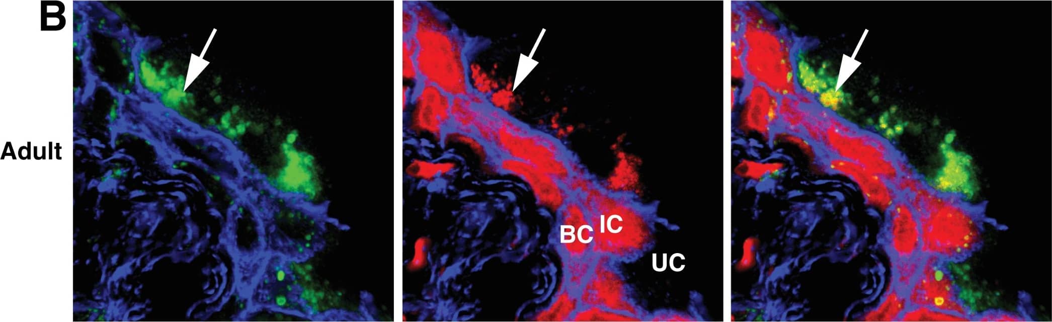 Immunocytochemistry/ Immunofluorescence: LIMPII/SR-B2 Antibody [NB400-129] - Lysotracker Red accumulates in endolysosomes.Immunofluorescence of young (A), adult (B), & aged (C) urothelium incubated with Lysotracker Red (red) & co-stained with antibodies to LIMP2 (green structures) & phalloidin (blue), which labels the cortical actin cytoskeleton. Large, Lysotracker Red-positive endolysosomes are marked with white arrows. Underlying intermediate (IC) & basal cells (BC) show non-specific cytoplasmic Lysotracker Red staining that did not appear in umbrella cells (UC). Image collected & cropped by CiteAb from the following publication (//pubmed.ncbi.nlm.nih.gov/29883476), licensed under a CC-BY license. Not internally tested by Novus Biologicals.