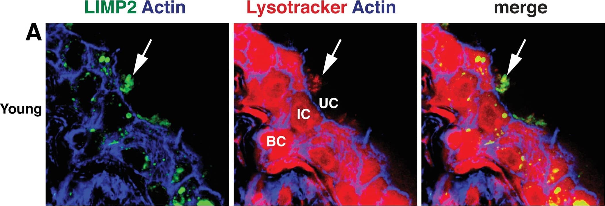 Immunocytochemistry/ Immunofluorescence: LIMPII/SR-B2 Antibody [NB400-129] - Lysotracker Red accumulates in endolysosomes.Immunofluorescence of young (A), adult (B), & aged (C) urothelium incubated with Lysotracker Red (red) & co-stained with antibodies to LIMP2 (green structures) & phalloidin (blue), which labels the cortical actin cytoskeleton. Large, Lysotracker Red-positive endolysosomes are marked with white arrows. Underlying intermediate (IC) & basal cells (BC) show non-specific cytoplasmic Lysotracker Red staining that did not appear in umbrella cells (UC). Image collected & cropped by CiteAb from the following publication (//pubmed.ncbi.nlm.nih.gov/29883476), licensed under a CC-BY license. Not internally tested by Novus Biologicals.