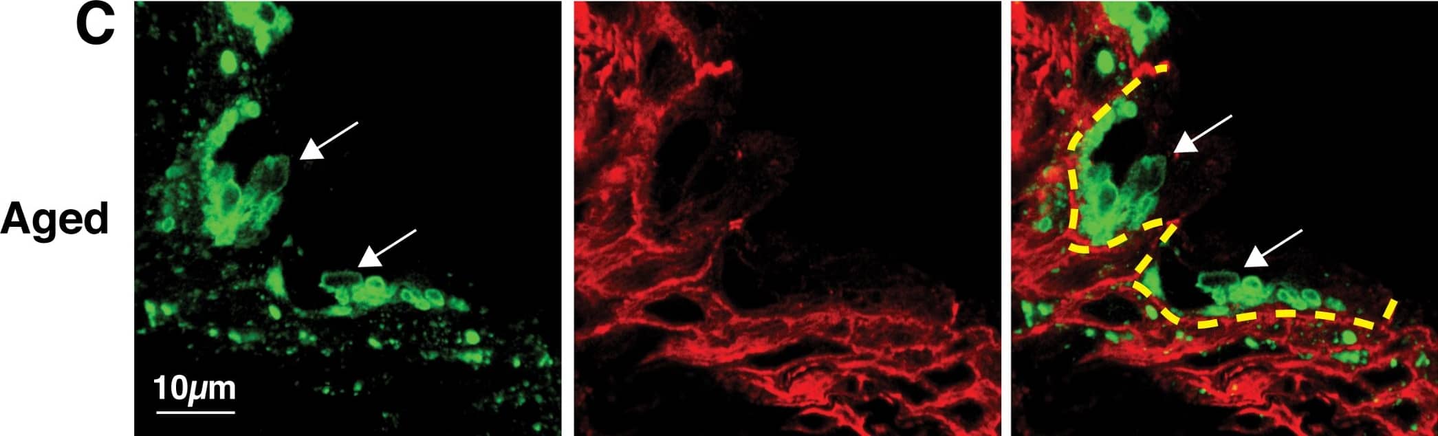 Immunocytochemistry/ Immunofluorescence: LIMPII/SR-B2 Antibody [NB400-129] - Comparison of LIMP2-positive organelles in young (A), adult (B), & aged (C) rat urothelium. LIMP2-positive structures (green) shown in umbrella cells (delineated by dashed yellow line). Rhodamine phalloidin (red), which labels the cortical actin cytoskeleton, was used to show cell borders. Umbrella cells show an apparent, age-related increase in LIMP2 staining (white arrows). Image collected & cropped by CiteAb from the following publication (//pubmed.ncbi.nlm.nih.gov/29883476), licensed under a CC-BY license. Not internally tested by Novus Biologicals.