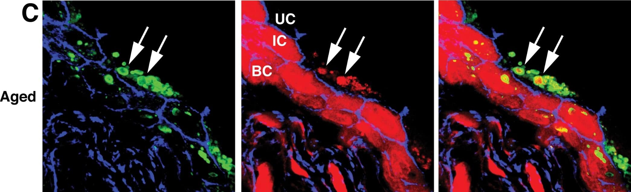 Immunocytochemistry/ Immunofluorescence: LIMPII/SR-B2 Antibody [NB400-129] - Lysotracker Red accumulates in endolysosomes.Immunofluorescence of young (A), adult (B), & aged (C) urothelium incubated with Lysotracker Red (red) & co-stained with antibodies to LIMP2 (green structures) & phalloidin (blue), which labels the cortical actin cytoskeleton. Large, Lysotracker Red-positive endolysosomes are marked with white arrows. Underlying intermediate (IC) & basal cells (BC) show non-specific cytoplasmic Lysotracker Red staining that did not appear in umbrella cells (UC). Image collected & cropped by CiteAb from the following publication (//pubmed.ncbi.nlm.nih.gov/29883476), licensed under a CC-BY license. Not internally tested by Novus Biologicals.