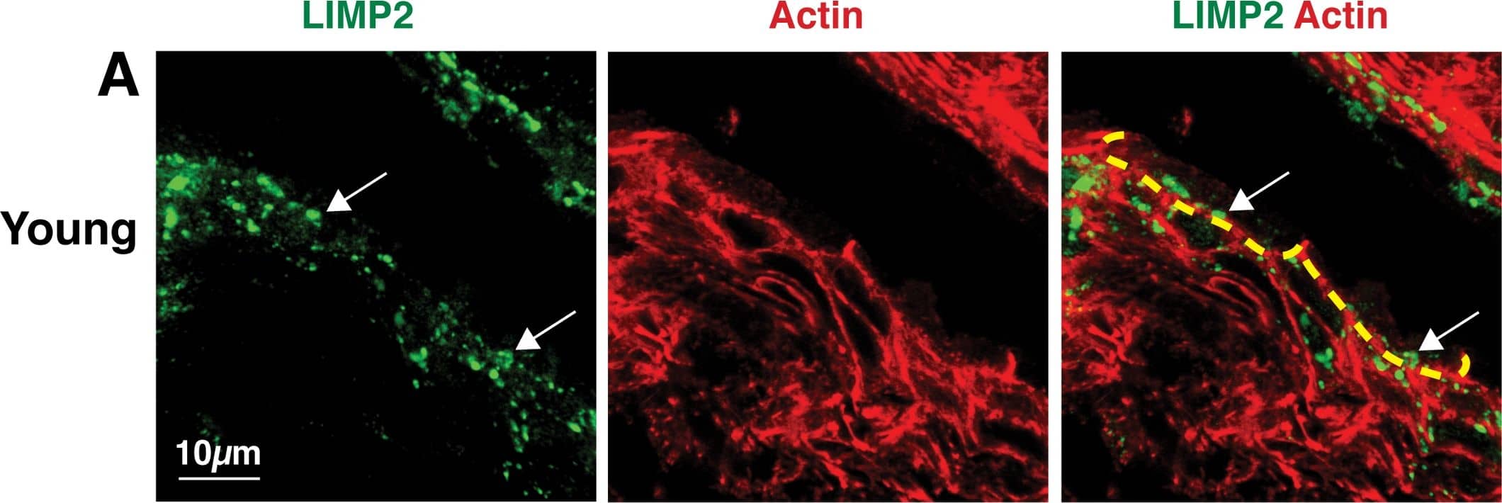 Immunocytochemistry/ Immunofluorescence: LIMPII/SR-B2 Antibody [NB400-129] - Comparison of LIMP2-positive organelles in young (A), adult (B), & aged (C) rat urothelium. LIMP2-positive structures (green) shown in umbrella cells (delineated by dashed yellow line). Rhodamine phalloidin (red), which labels the cortical actin cytoskeleton, was used to show cell borders. Umbrella cells show an apparent, age-related increase in LIMP2 staining (white arrows). Image collected & cropped by CiteAb from the following publication (//pubmed.ncbi.nlm.nih.gov/29883476), licensed under a CC-BY license. Not internally tested by Novus Biologicals.