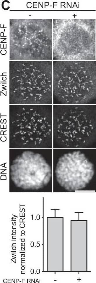 Kinetochore localization of RZZ and MAD1 are independent of CENP-E and CENP-F.A–H, representative images and quantification of protein kinetochore levels in HeLa cells mock-treated or depleted of Zwilch (A), CENP-E (B, E, and H), CENP-F (C, F, and G), or co-depleted of CENP-E and CENP-F (D). Scale bar, 10 μm. Zwilch depletion does not affect the localization of CENP-E (A). CENP-E depletion does not affect the localization of Zwilch (B), MAD1 (E), and CENP-F (H). Similarly, CENP-F depletion does not interfere with the recruitment of Zwilch (C), MAD1 (F), and CENP-E (G). Co-depletion of CENP-E and CENP-F has no effects on localization of Zwilch (D). The graphs show mean intensity of one (B, C, and E), two (D and F), or three (A, G, and H) experiments; the error bars indicate S.E., and the mean values for nondepleted cells are set to 1. Elements in the left column of A (negative controls of the RNAi experiments) are also shown in Fig. S3C. Elements in G are shown again in Fig. S2E. Image collected and cropped by CiteAb from the following open publication (//pubmed.ncbi.nlm.nih.gov/29748388), licensed under a CC-BY license. Not internally tested by Novus Biologicals.