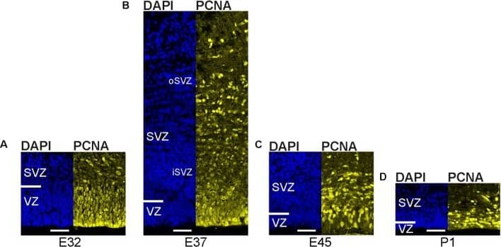 Immunocytochemistry/ Immunofluorescence: PCNA Antibody (PC10) [NB500-106] - Development of the germinal zones in the tree shrew neocortex. (A–D) Immunofluorescence for PCNA (yellow) & DAPI staining (blue) on 30 μm-cryosections of E32–P1 tree shrew neocortex. The top margin of the image corresponds to the transition zone SVZ/intermediate zone. Scale bars, 50 μm. VZ, ventricular zone; SVZ, subventricular zone; iSVZ, inner SVZ; oSVZ, outer SVZ. (E) Quantification of the VZ thickness of the E32–P1 tree shrew neocortex. (F) Quantification of the SVZ thickness of the E32–P1 tree shrew neocortex. (G) Quantification of the VZ & SVZ thickness of the E32–P1 tree shrew neocortex, expressed as percentage of the sum of VZ & SVZ. (H) Quantification of the iSVZ & oSVZ thickness of the E37 tree shrew neocortex, expressed as percentage of the sum of iSVZ & oSVZ. (E–H) Data represent mean ± SD & were obtained from two consecutive sections of two brains each. Image collected & cropped by CiteAb from the following publication (//pubmed.ncbi.nlm.nih.gov/29725291), licensed under a CC-BY license. Not internally tested by Novus Biologicals.