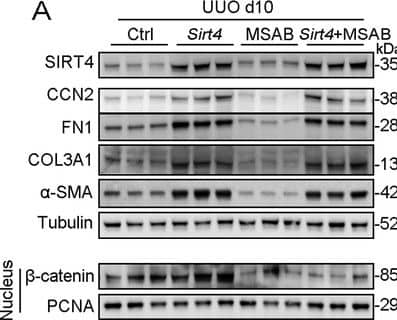Inhibition of nucleus accumulation of  beta -catenin failed to suppresses kidney fibrosis induced by SIRT4 overexpression in UUO mice.(A–C) AAV9-Ksp-Sirt4 or AAV-Ctrl was injected into kidneys of mice in situ at three independent points in situ. After 2-week transfection, the mice received UUO surgery. After UUO surgery, mice were treated with vehicle or MSAB for 10 days (n=6 per group). (A) Western blot analysis of the expression of SIRT4, CCN2, FN1, COL3A1,  alpha -SMA, and Tubulin in the kidneys from mice. (B) Representative images of Masson’s trichrome staining and Sirius red staining in kidney sections of mice (scale bar, 100 μm). (C) The mRNA level of Col1a1, Fn1, Eln, Ccn2, Acta2, and Col3a1 in the kidney of mice. For all panels, data are presented as mean +/- SD. ns: not significant difference, *p<0.05, **p<0.01, ***p<0.001 by one-way ANOVA with Bonferroni correction test.Figure 8—figure supplement 3—source data 1.Original files for western blot analysis displayed in Figure 8—figure supplement 3A.Figure 8—figure supplement 3—source data 2.The uncropped gels or blots with the relevant bands clearly labeled in Figure 8—figure supplement 3A.Original files for western blot analysis displayed in Figure 8—figure supplement 3A.The uncropped gels or blots with the relevant bands clearly labeled in Figure 8—figure supplement 3A. Image collected and cropped by CiteAb from the following open publication (//elifesciences.org/articles/98524), licensed under a CC-BY license. Not internally tested by Novus Biologicals.