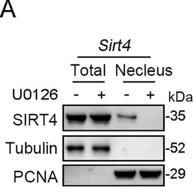 U0126 prevents SIRT4 overexpression induced kidney fibrosis in UUO mice.(A, B) AAV9-Ksp-Sirt4 was injected into kidneys of mice in situ at three independent points in situ. After 2-week transfection, the mice received UUO surgery, and then mice were treated with U0126 (10 mg/kg body weight) or vehicle for 10 days (n=6 per group). (A) Organelle separation experiment and immunoblot analysis detected the localization of SIRT4 and Tubulin in the kidneys of mice. (B) Representative images of immunohistochemical staining of SIRT4 (scale bar, 50 μm) in the kidney sections of mice.Figure 8—figure supplement 1—source data 1.Original files for western blot analysis displayed in Figure 8—figure supplement 1A.Figure 8—figure supplement 1—source data 2.The uncropped gels or blots with the relevant bands clearly labeled in Figure 8—figure supplement 1A.Original files for western blot analysis displayed in Figure 8—figure supplement 1A.The uncropped gels or blots with the relevant bands clearly labeled in Figure 8—figure supplement 1A. Image collected and cropped by CiteAb from the following open publication (//elifesciences.org/articles/98524), licensed under a CC-BY license. Not internally tested by Novus Biologicals.