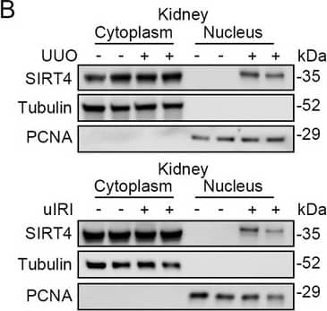 Nuclear accumulation of SIRT4 is increased in renal tubules after injury.(A) Western blots analysis of SIRT4, FN1, COL1A1, and Tubulin in the kidney of UUO, uIRI, and sham mice (control group). (B) Nuclear fractions were prepared from the kidney of UUO, uIRI, and sham mice. Nuclear PCNA and cytoplasmic tubulin were used as controls. (C, D) Representative images of immunohistochemical staining of SIRT4 (scale bar, 50 μm) in the kidneys from mice that underwent sham surgery, UUO surgery on day 10 post surgery or uIRI surgery on day 28 post surgery. (E, F) Representative images of Masson’s trichrome staining (the upper panel; scale bar = 50 μm) and SIRT4 immumohistochemical staining (the bottom panel; scale bar = 20 μm) in the kidney sections from patients with CKD (n=8) and minimal change disease (control group, n=1).Figure 1—source data 1.Original files for western blot analysis displayed in Figure 1A, B.Figure 1—source data 2.The uncropped gels or blots with the relevant bands clearly labeled in Figure 1A and B.Original files for western blot analysis displayed in Figure 1A, B.The uncropped gels or blots with the relevant bands clearly labeled in Figure 1A and B. Image collected and cropped by CiteAb from the following open publication (//elifesciences.org/articles/98524), licensed under a CC-BY license. Not internally tested by Novus Biologicals.