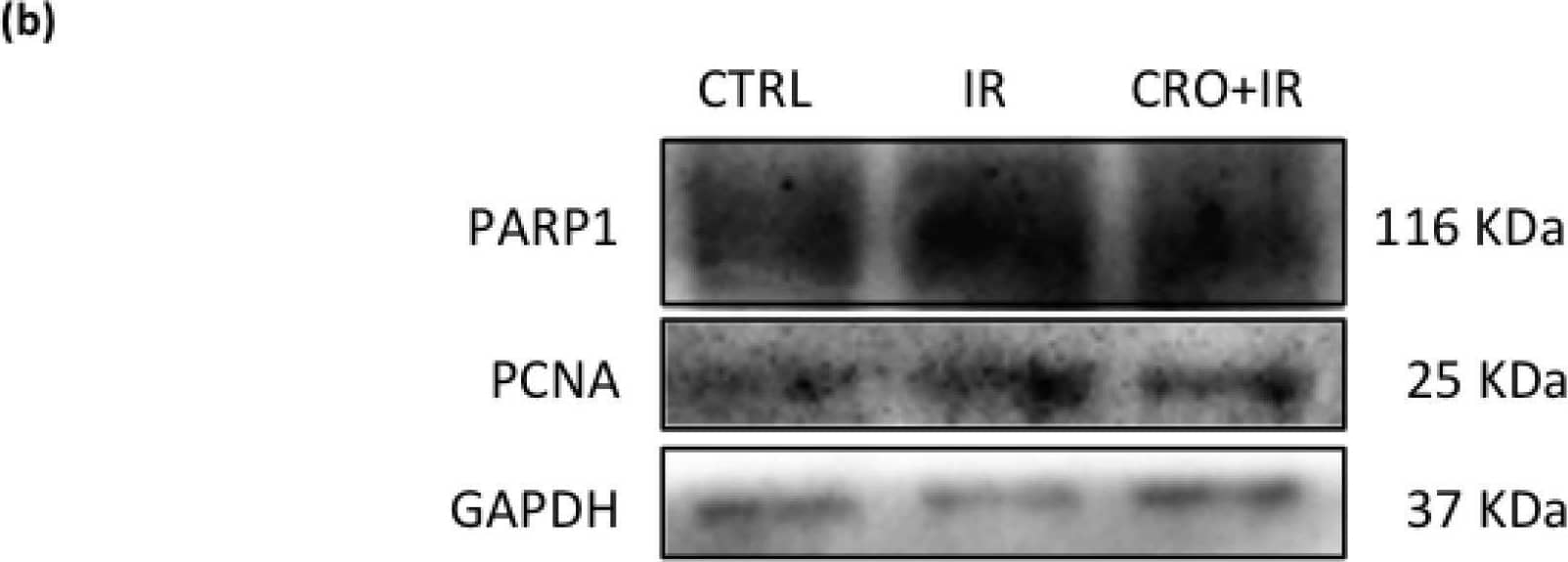 (a) Western blot analysis of PARP1 and PCNA protein levels. (b) Representative images of immunoreactive bands. Data are presented as means +/- SEM of densitometric analysis of immunoreactive bands normalized to internal reference protein (GAPDH). One-way ANOVA p < 0.05; a,bp < 0.05, Holm–Sidak post hoc multiple comparison. Image collected and cropped by CiteAb from the following open publication (//pubmed.ncbi.nlm.nih.gov/33802807), licensed under a CC-BY license. Not internally tested by Novus Biologicals.