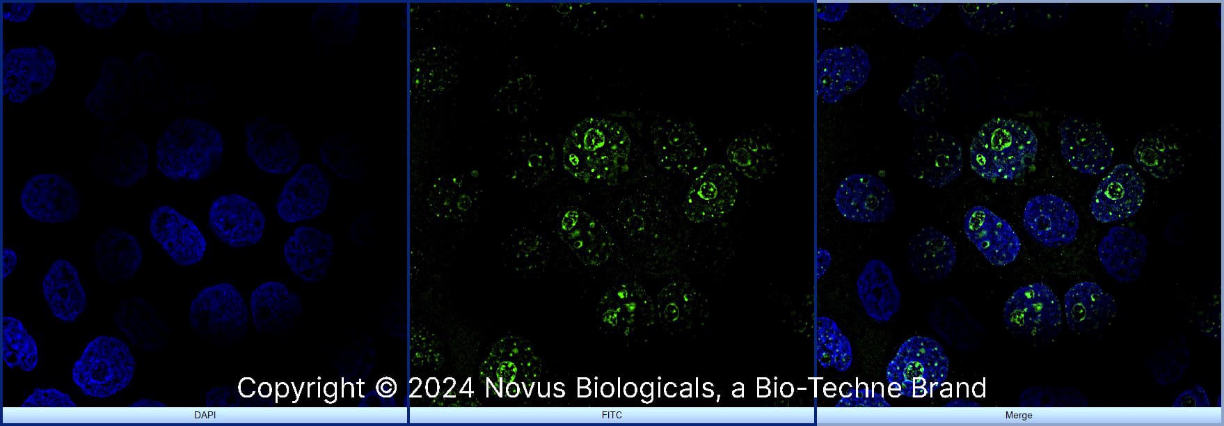 Ki67/MKI67 was detected in immersion fixed A431 human skin carcinoma cell line using Rabbit anti- Ki67/MKI67 Affinity Purified Polyclonal Antibody conjugated to Alexa Fluor® 488 (Catalog # NB500-170AF488) (green) at 2 µg/mL overnight at 4C. Cells were counterstained with DAPI (blue). Cells were imaged using a 100X objective and digitally deconvolved.