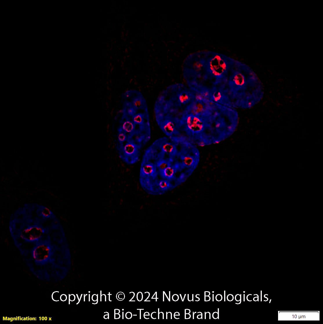 Ki67/MKI67 was detected in immersion fixed MCF7 human breast cancer cell line using Rabbit anti-Ki67/MKI67 Affinity Purified Polyclonal Antibody conjugated to Biotin (Catalog # NB500-170B) at 5 µg/mL overnight at 4C. Cells were stained using Streptavidin conjugated to DyLight 550 (red) and counterstained with DAPI (blue). Cells were imaged using a 100X objective and digitally deconvolved.