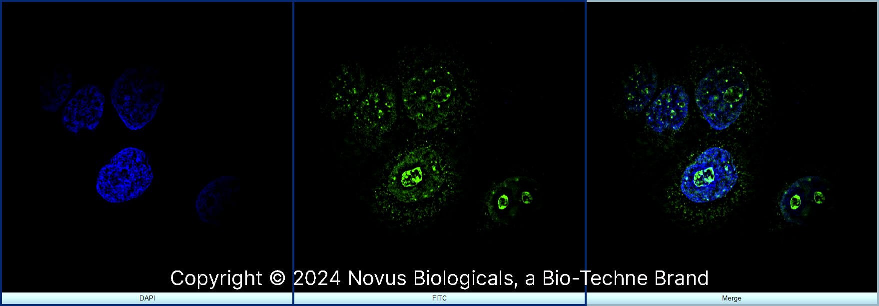 Ki67/MKI67 was detected in immersion fixed A431 human skin carcinoma cell line using Rabbit anti- Ki67/MKI67 Affinity Purified Polyclonal Antibody conjugated to DyLight 488 (Catalog # NB500-170G) (green) at 5 µg/mL overnight at 4C. Cells were counterstained with DAPI (blue). Cells were imaged using a 100X objective and digitally deconvolved.