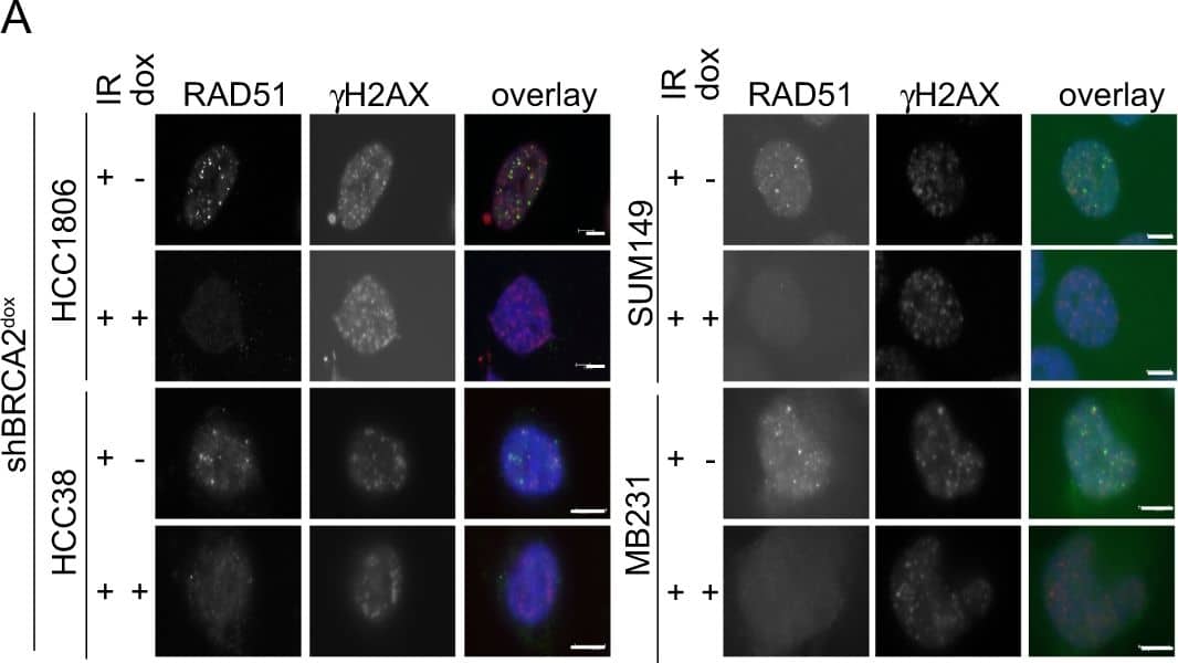 Immunocytochemistry/ Immunofluorescence: TPX2 Antibody [NB500-179] - Depletion of TPX2 or Aurora-A reduces cell viability of BRCA2-deficient breast cancer cells. a HCC1806-shBRCA2dox, HCC38-shBRCA2dox, SUM149-shBRCA2dox, & MB231-shBRCA2dox were grown on coverslips & treated with doxycycline (3 days) and/or irradiated (IR, 5 Gy) as indicated. Subsequently, cells were stained for RAD51 &  gamma H2AX. Scale bars represent 5 μm. b Quantification of results from a. Percentages of cells with ≥5 RAD51 foci per nucleus are indicated (n ≥ 31). c Percentages of cell survival of doxycycline-treated cells vs untreated cells, transfected with indicated siRNAs. Unpaired two-tailed t tests were used to test for statistical significance (*p ≤ 0.05, **p ≤ 0.01, ***p ≤ 0.001). d BT-549 cells were transfected with siTPX2 or control siRNA (CTR). Cells were grown on coverslips for 3 days after which they were incubated with EdU conjugated to azide-Alexa 488 (10 μM) for 15 min. Subsequently, cells were fixed & stained for 53BP1 &  gamma H2AX. Amounts of 53BP1 &  gamma H2AX foci per cell of at least 30 EdU-positive cells were counted. Means & standard deviations are depicted. Mann–Whitney U tests were used to analyze statistical significance (*p ≤ 0.05, ** = p ≤ 0.01, ***p ≤ 0.001, ns not significant). e BT-549 cells were transfected as in d, irradiated (IR, 5 Gy), & fixated 0.5 or 6 h after irradiation. Amounts of 53BP1 &  gamma H2AX foci per cell were counted. Means & standard deviations are depicted. Mann–Whitney U tests were used to analyze statistical significance (*p ≤ 0.05, **p ≤ 0.01, ***p ≤ 0.001, ns = not significant) Image collected & cropped by CiteAb from the following publication (//pubmed.ncbi.nlm.nih.gov/30177840), licensed under a CC-BY license. Not internally tested by Novus Biologicals.