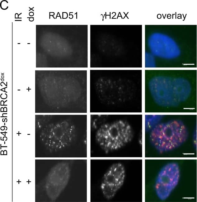 Immunocytochemistry/ Immunofluorescence: TPX2 Antibody [NB500-179] - TPX2 depletion preferentially affects cell viability in BRCA2-deficient cancer cells. a BT-549-shBRCA2dox cells were left untreated or were treated with doxycycline (2 or 4 days), & subsequently harvested for western blotting for BRCA2 & actin. b BT-549-shBRCA2dox cells were treated as in panel A, & mRNA expression levels of BRCA2 were analyzed relative to GAPDH using qRT-PCR. c BT-549-shBRCA2dox cells were grown on coverslips & treated with doxycycline (3 days) and/or irradiated (IR, 5 Gy) as indicated. At 3 h after irradiation, cells were fixed & analyzed for RAD51 &  gamma H2AX foci formation. Scale bars represent 5 μm. d Percentages of cells with ≥5 RAD51 foci per nucleus are indicated. (n ≥ 50 per condition). e BT-549-shBRCA2dox cells were treated with doxycycline (3 days) & were subsequently transfected with indicated siRNAs. A total of 30,000 cells were plated 48 h following transfection. Viable cells were counted 5 days later. Percentages of cell survival of doxycycline-treated vs untreated cells are depicted. Error bars indicate standard deviations of two experimental replicates. Unpaired two-tailed t tests were used to test for statistical significance (*p ≤ 0.05, **p ≤ 0.01, ***p ≤ 0.001) Image collected & cropped by CiteAb from the following publication (//pubmed.ncbi.nlm.nih.gov/30177840), licensed under a CC-BY license. Not internally tested by Novus Biologicals.