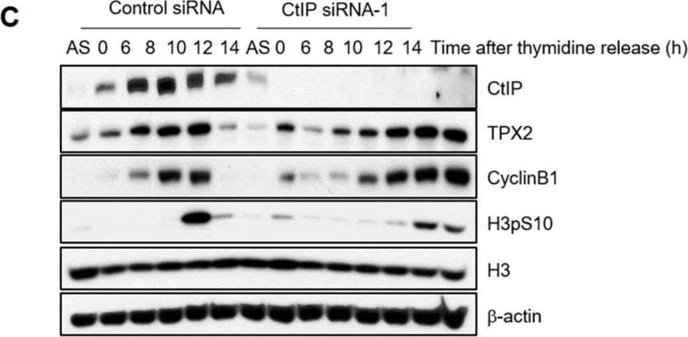 CtIP depletion causes improper progression of mitosis. (A) The progression of mitosis in HeLa cells was monitored by time-lapse microscopy. HeLa cells were transfected with control or CtIP-1 or siRNA. After 48 h, control and CtIP-depleted HeLa cells were seeded in 12-well plates and transfected with GFP-tagged histone H2B. Fluorescent images were obtained every 5 min starting at the stage of nuclear envelope breakdown. (B) A quantification of the time from nuclear envelope breakdown to anaphase onset in control cells and CtIP-depleted cells. Bars represent the mean +/- SD from three independent experiments. **, p < 0.01, compared to control cells. (C) Delayed mitosis progression in CtIP-depleted cells was confirmed by prolonged phosphorylation of histone H3 (pH3S10). Control and CtIP-depleted HeLa cells were synchronized with a double thymidine block to arrest at the G1/S boundary and released from this block for indicated times. Total proteins collected at the indicated times after release were analyzed by Western blotting using anti-pH3S10 antibody. Histone H3 antibody was used as a loading control. Image collected and cropped by CiteAb from the following open publication (//www.mdpi.com/2073-4409/11/18/2814), licensed under a CC-BY license. Not internally tested by Novus Biologicals.